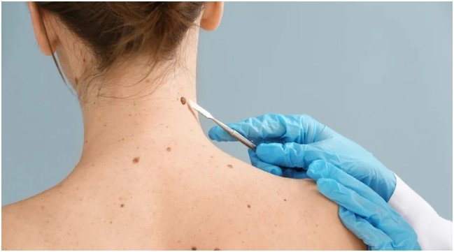 Understanding Skin Check Procedures