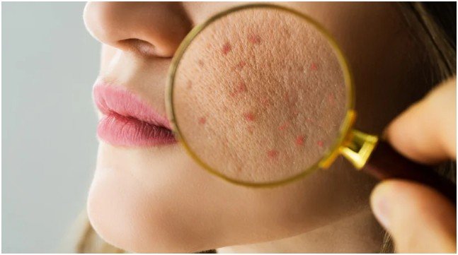 The Role of Regular Skin Checks in Long-Term Health